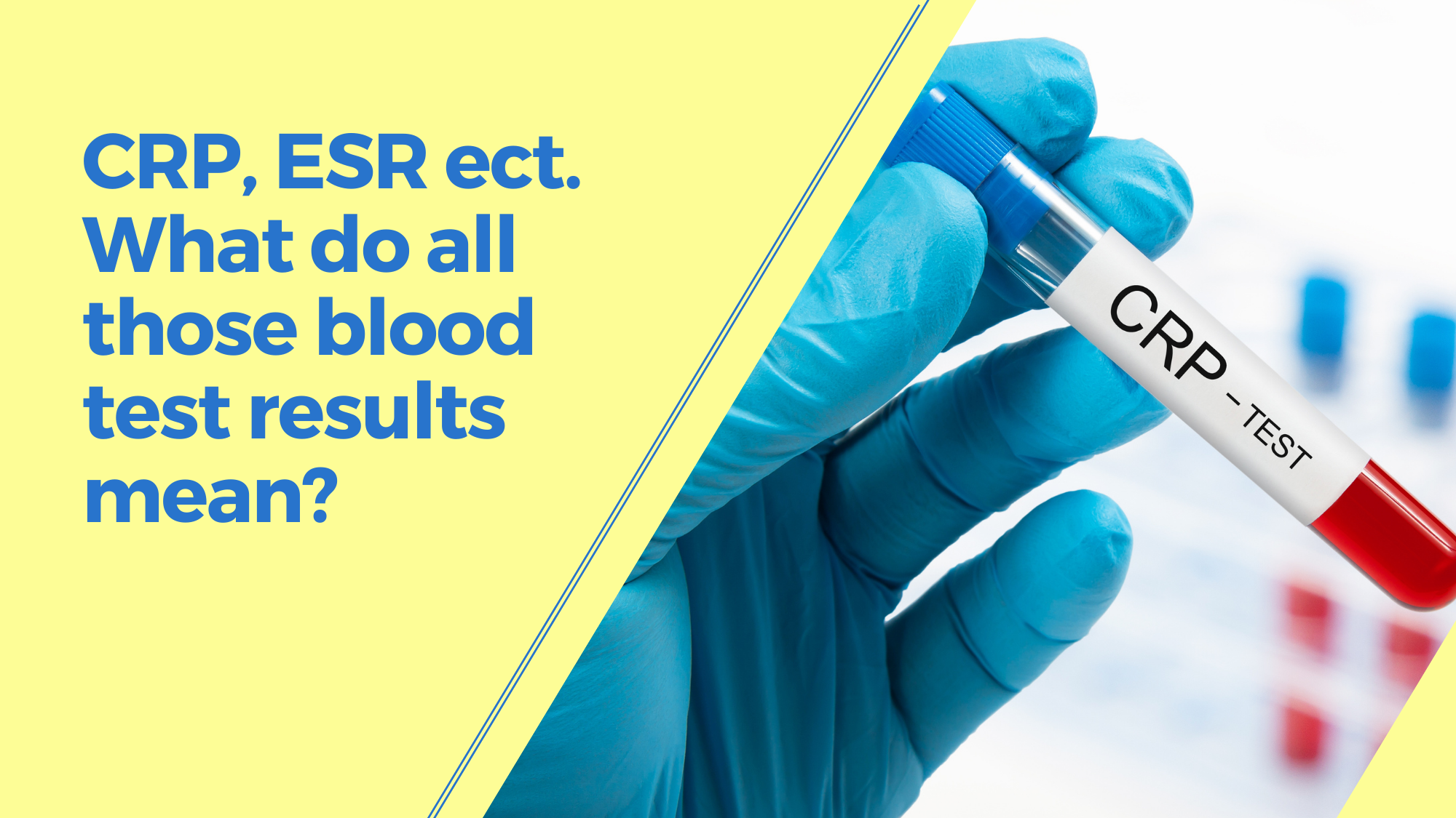 crp-esr-ect-what-do-all-those-blood-test-results-mean